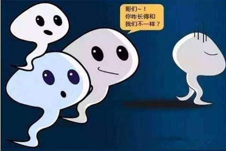  无精症会导致不育? 