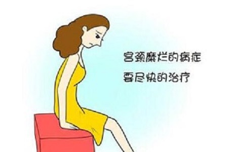  治疗宫颈糜烂如何选择便宜靠谱的医院 